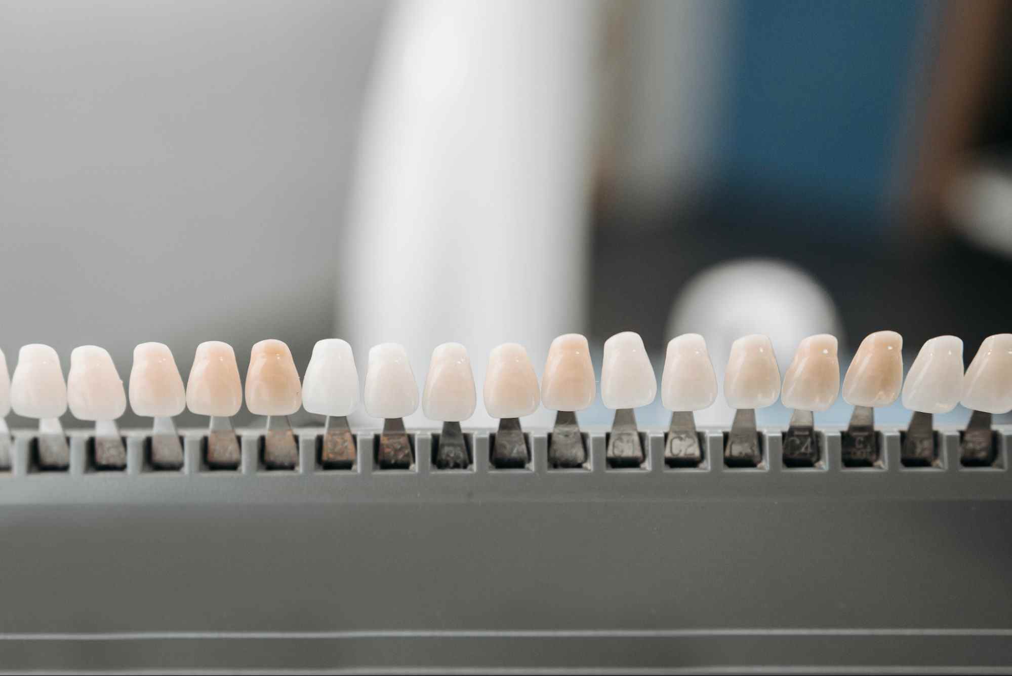 Composite Veneer