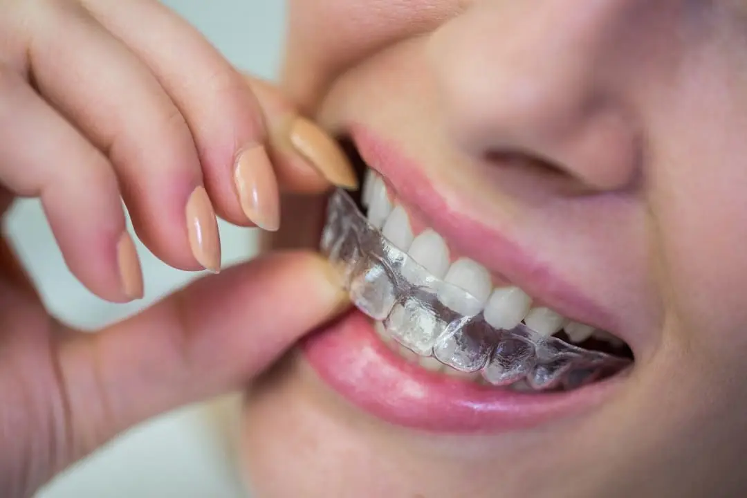 Invisalign Box Hill