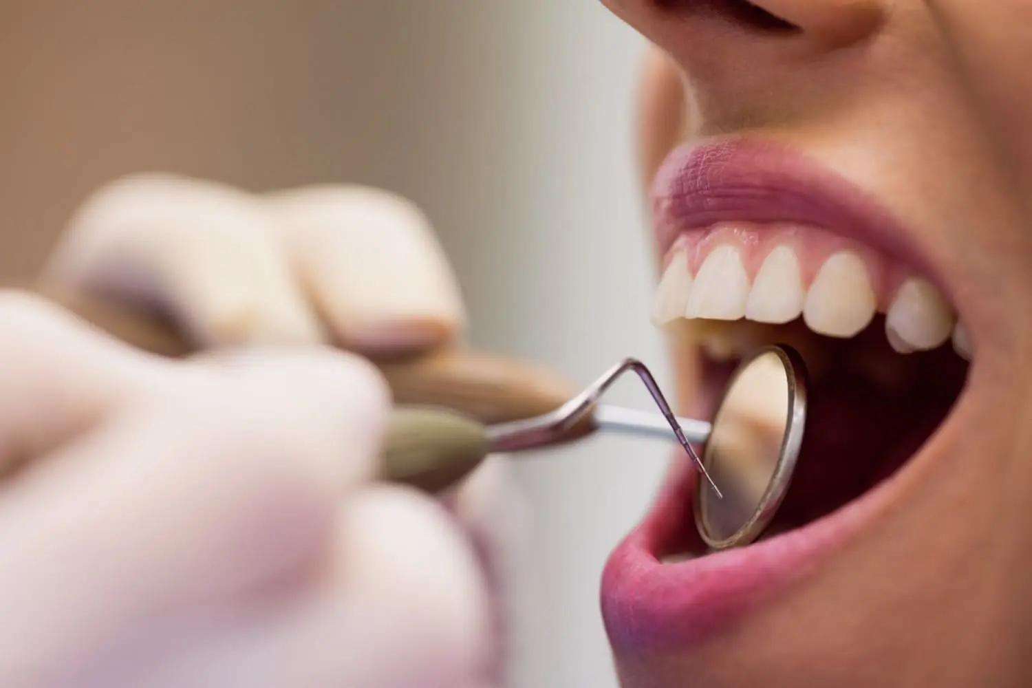 Dental Cavities Causes, Treatment, and Prevention