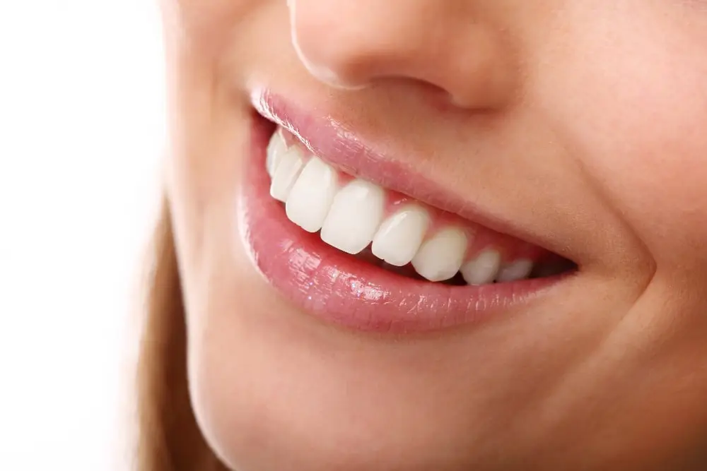 Teeth Whitening in Box Hill NSW