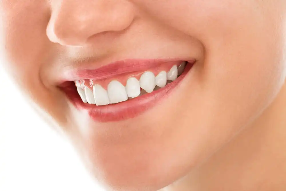 Smile with Teeth Whitening
