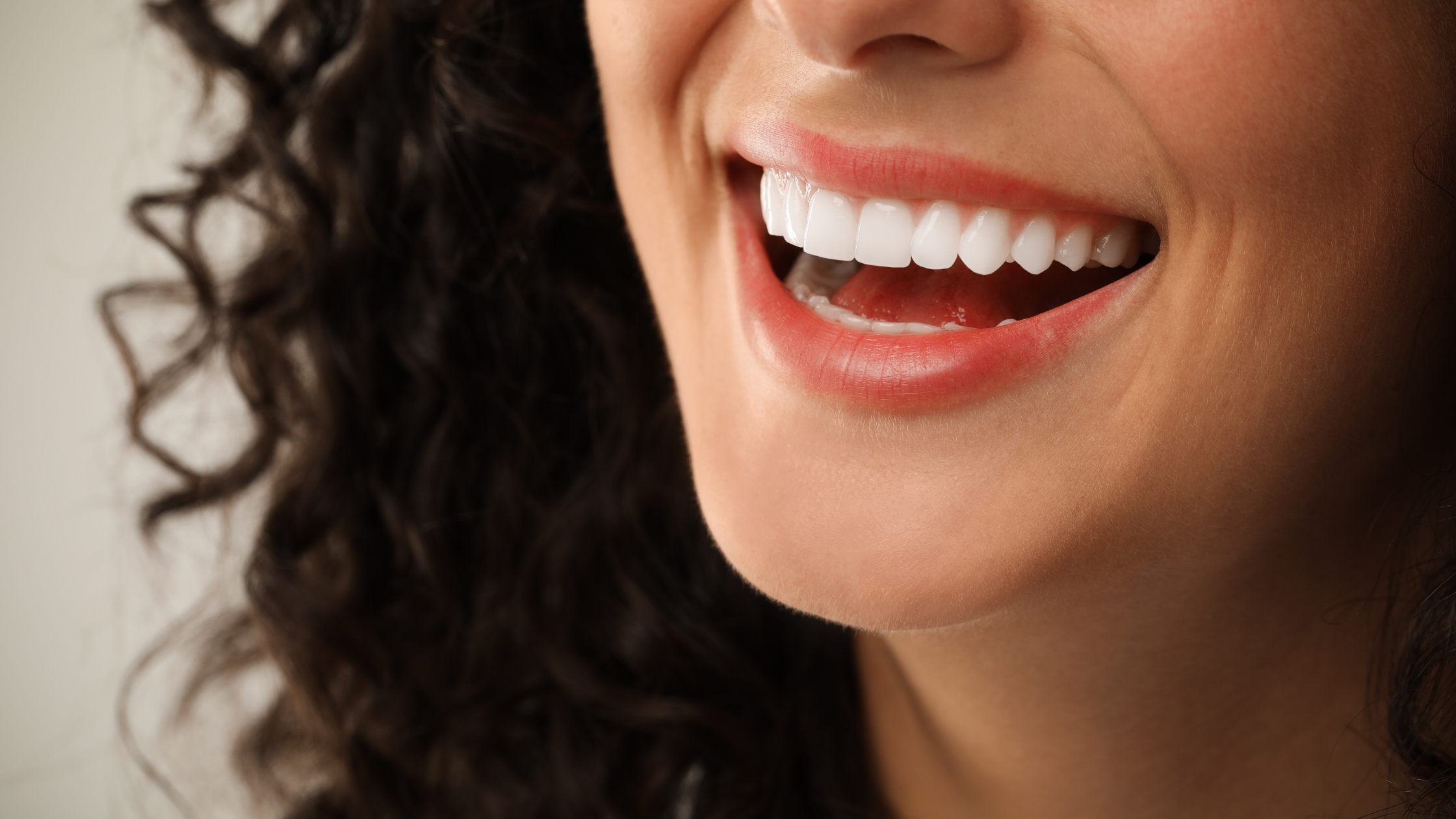 Woman smiling with perfect white teeth after cosmetic veneers treatment