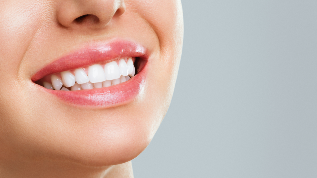 Close-up of bright white teeth after whitening treatment.