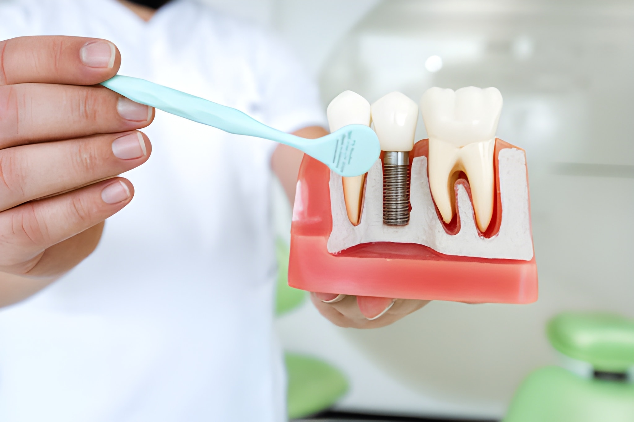 Implant Dentistry
